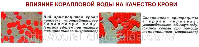 Сколько дней длится насморк у детей